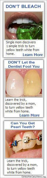 Don't Let the Dentist Fool You  DO NOT BLEACH  Read more here...